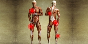 Muskelkater